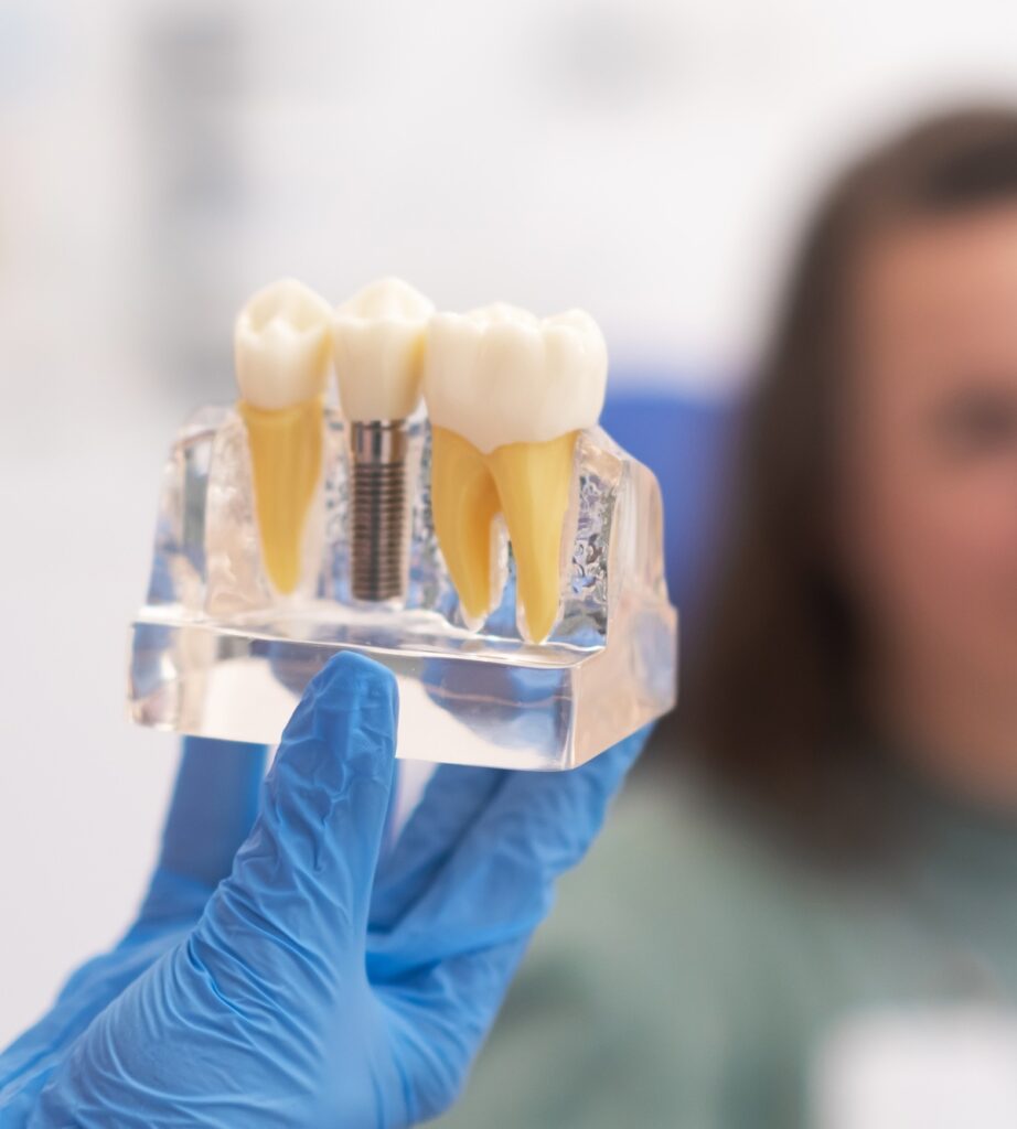 close-up patient dental implant treatment plan. The focus is teeth implant model in dentists hand