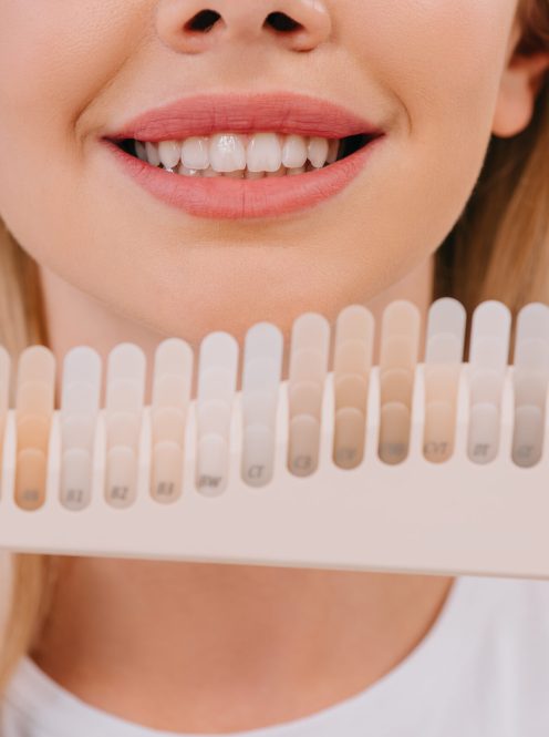teeth Whitening dentist