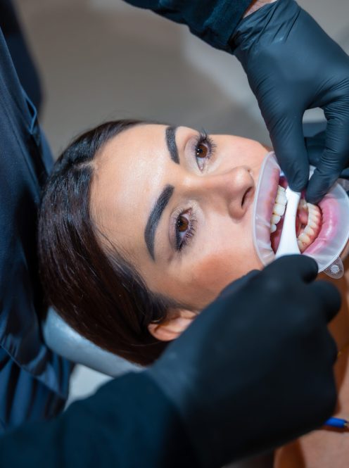 teeth Whitening nj
