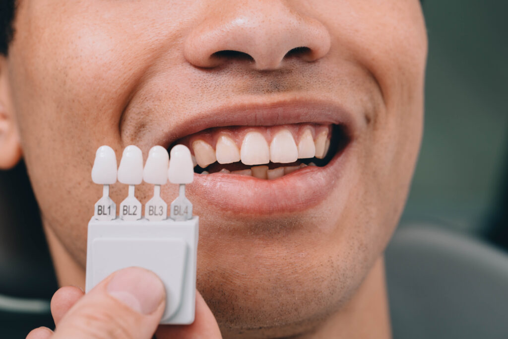cosmetic dental treatment
