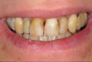 custom_images_gallery_before01